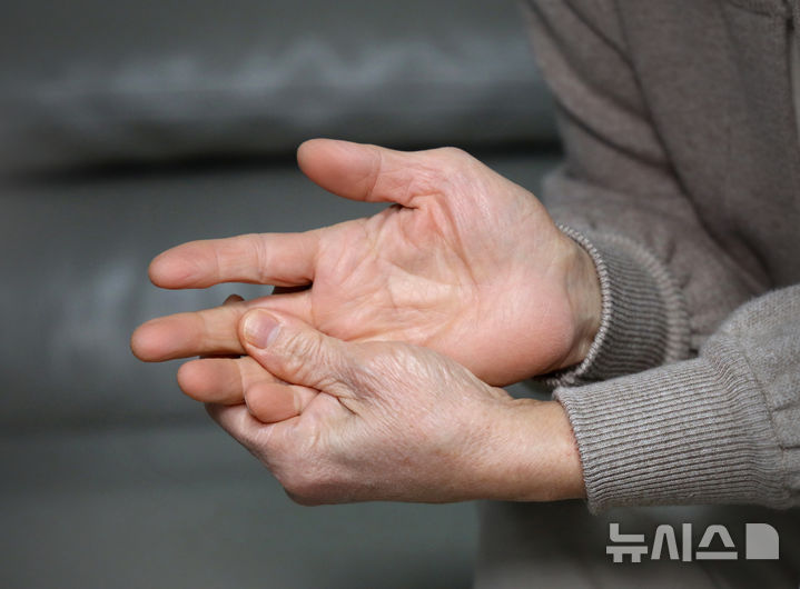손가락 붓고 욱신, 방치했다간…관절변형 오는 '이 질환'
