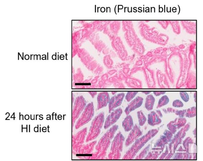 [서울=뉴시스] 고철분 다이어트 동물의 장내(아래)에서 보통 다이어트 동물(위)보다 철이 많이 축적됐다. (사진= 세브란스 병원 제공)