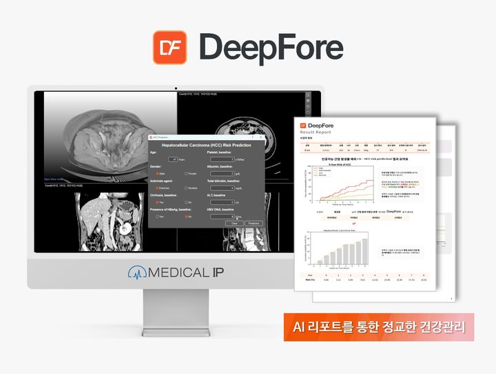 [서울=뉴시스] 메디컬아이피의 AI 간암 위험 예측 솔루션 '딥포'는 만성 B형 간염 환자의 컴퓨터 단층촬영(CT) 영상 기반 바이오마커와 전자 의무 기록 시스템(EMR) 기반 혈액 데이터를 종합 분석해 향후 8년 내 간세포암 발병 확률을 예측한다. (사진=메디컬아이피 제공) 2025.10.31. photo@newsis.com *재판매 및 DB 금지