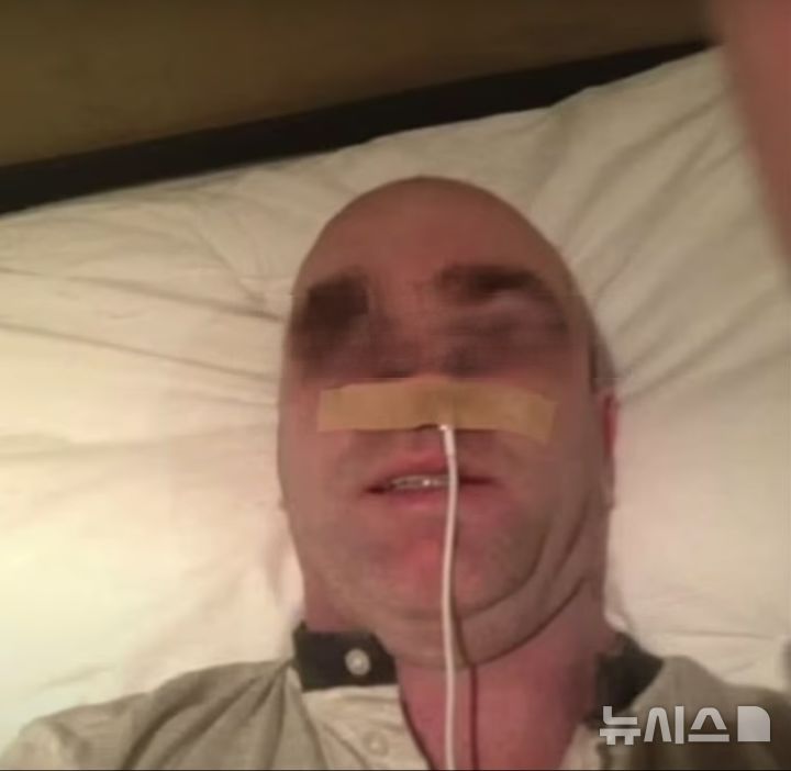 [서울=뉴시스](사진=데일리메일)