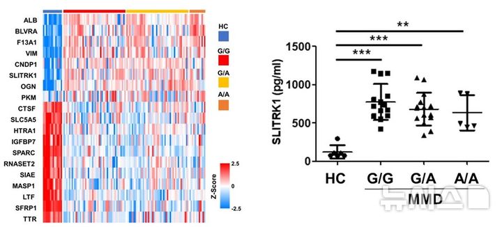 [서울=뉴시스] 모야모야병 환자군 및 대조군의 뇌척수액 단백체 분석 결과. (사진= 서울대병원 제공)
