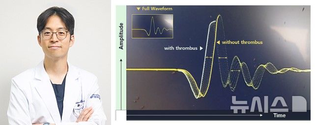 [서울=뉴시스] 임공민 분당차병원 흉부외과 교수, 혈전의 유무에 따란 초음파 센서상의 파형 변화. (사진= 분당차병원 제공)&nbsp;&nbsp;&nbsp;&nbsp;&nbsp; 