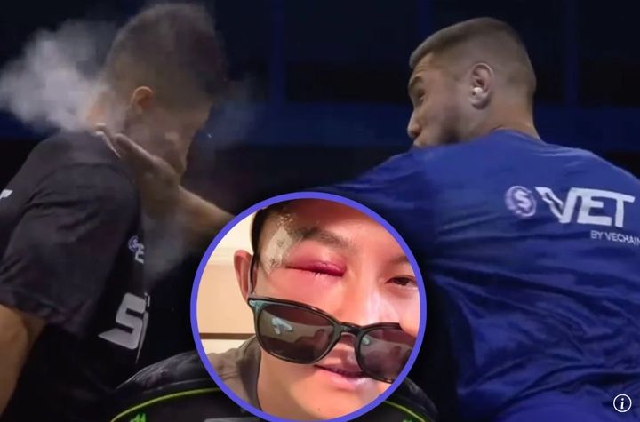 [뉴시스]세계 파워 슬랩 대회에서 부상을 당한 중국 자오훙강 선수의 모습. (사진 = SCMP 캡처) *재판매 및 DB 금지