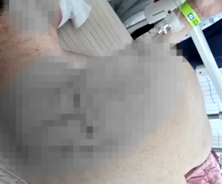 [뉴시스] 구조 직후 수탉의 모습. (사진 =  *재판매 및 DB 금지