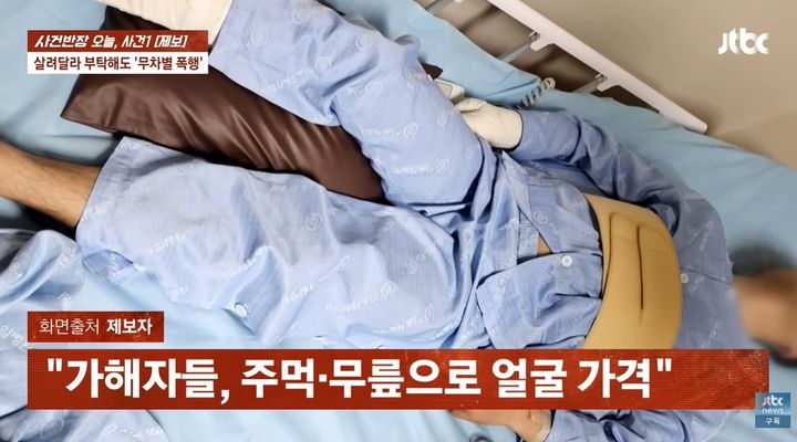 [뉴시스]20대 남성 두 명에게 무차별 폭행을 당한 남성이 입원해 있다. (사진 = JTBC 사건반장 캡처) *재판매 및 DB 금지