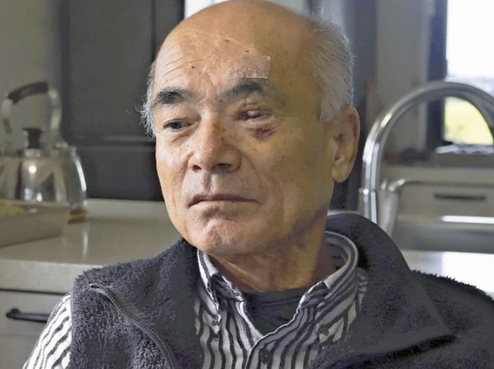 [뉴시스] 2년 전 곰에게 공격을 당해 중상을 입은 뒤 지금도 후유증에 시달리고 있는 오카노우에 다카시(74)의 사연이 전해졌다. 사진은 오카노우에 씨의 현재 모습. (사진 = 요미우리신문 캡처) 2025.11.16. *재판매 및 DB 금지