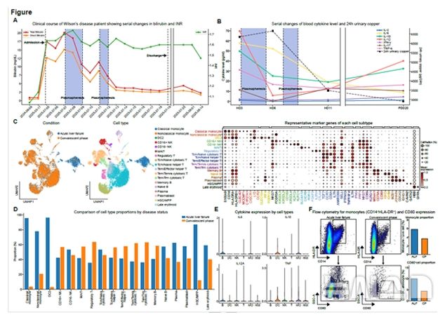 [서울=뉴시스] 윌슨병으로 급성간부전이 발생한 환자의 혈장 교환술 치료 후 임상경과 및 혈액세포 분석결과. (사진= 서울성모병원 제공)