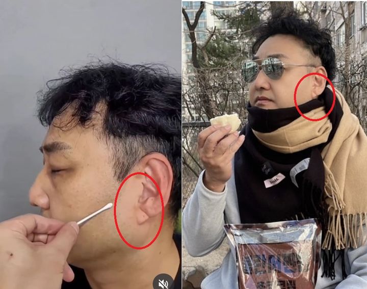 [서울=뉴시스]개그맨 김수용(59)이 최근 갑자기 의식을 잃고 쓰러져 병원에서 입원 치료를 받고 있는 가운데, 그의 귓볼에 있던 사선 주름이 전조증상이라는 주장이 제기됐다. (사진출처: 김수용 인스타그램 캡처) 2025.11.18.