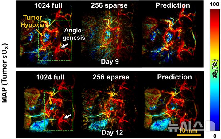 [포항=뉴시스] 송종욱기자 = 포스텍 연구팀이 비싼 장비가 아니어도 실시간으로 몸속에 있는 장기와 종양의 변화를 3D로 관찰하는 새 기술을 개발했다. 사진은 쥐 종양 모델에 개발한 프레임워크 적용 결과 : 시간에 따른 종양의 기능 정보 변화 추적. (사진=포스텍 제공) 2025.11.18. photo@newsis.com 