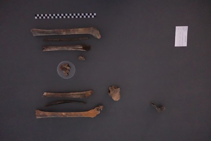 [서울=뉴시스]2024년 11월 대구광역시 군위군에서 발굴된 고(故) 구자길 일병의 유해. (사진=국방부 제공) 2025.11.21 *재판매 및 DB 금지