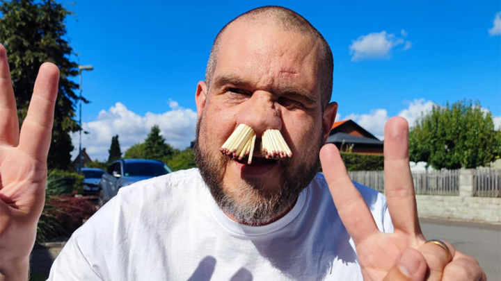 [뉴시스] 마틴 스트뢰비는 '콧구멍에 가장 많은 성냥 넣기' 부문에서 81개로 세계 기록을 경신했다. (사진='기네스월드레코드' 홈페이지 캡처) *재판매 및 DB 금지