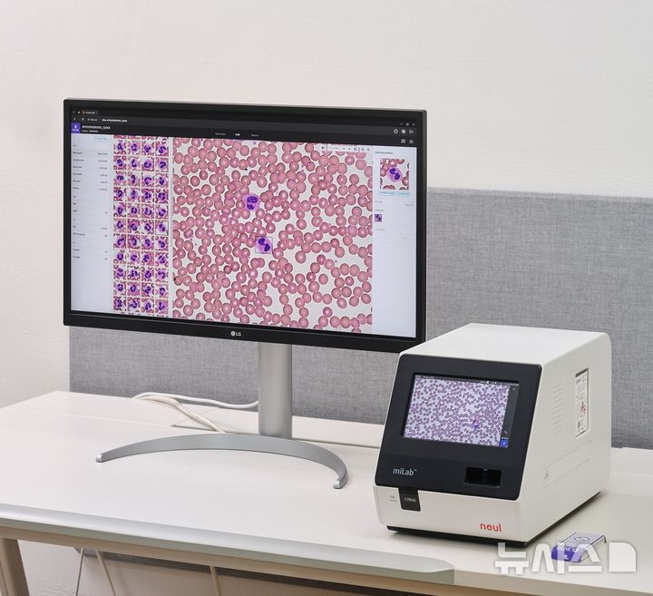 [서울=뉴시스] 전혈구검사(CBC)를 통합한 완전 자동화 혈액 분석 솔루션 'miLab BCM'. (사진= 노을 제공)
