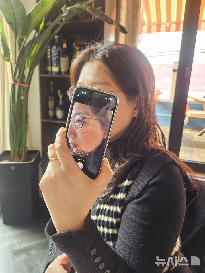 [서울=뉴시스] A씨가 피부진단 AI 모델 'ModelDerm'(모델더마톨로지) 앱을 사용해 피부암 여부를 테스트 하고있다. (사진= 독자 제공)