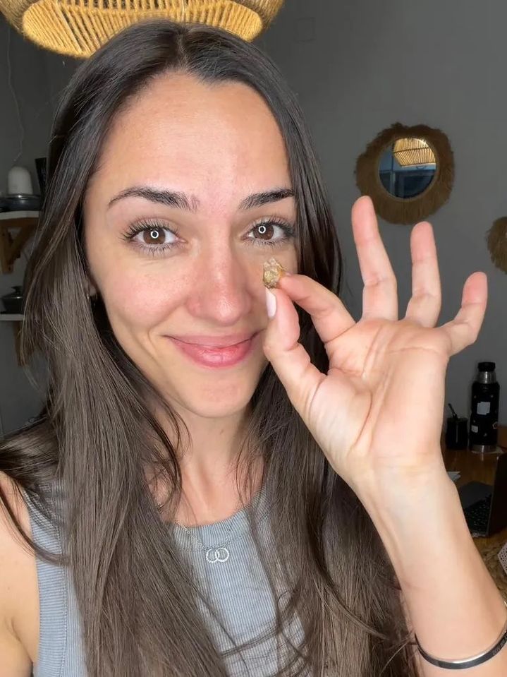 [뉴시스] 인플루언서 칸델라 레이바울드(35·여)가 자신의 코 속에서 나온 테이프 뭉치를 들고 있는 모습. (사진=잼프레스) 2025.11.30 *재판매 및 DB 금지