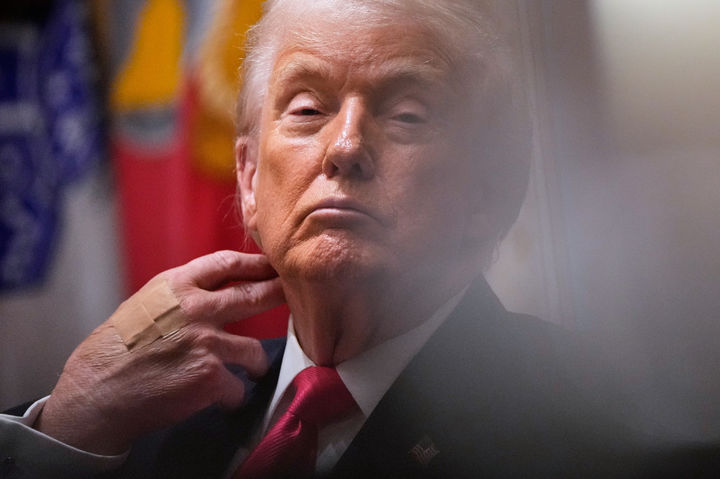 [워싱턴=AP/뉴시스] 2일(현지 시간) 미국 백악관에서 각료회의를 주재하는 도널드 트럼프 대통령의 오른쪽 손등에 반창고가 붙어 있다. 2025.12.03.