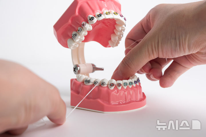 [서울=뉴시스] 치과 진료를 받고 부작용이 발생하거나 진료비를 과다 청구해 피해 구제를 신청한 사례가 늘어나고 있어 주의가 요구된다. (사진= 유토이미지 제공)