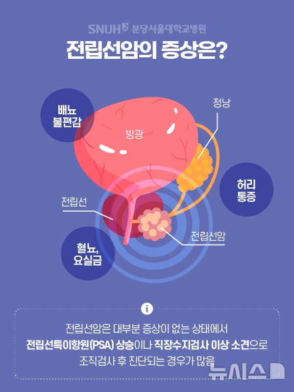 [서울=뉴시스] 전립선암은 대부분 증상이 없는 상태에서 전립선특이항원(PSA) 상승이나 직장수지검사에서 이상 소견으로 조직검사 후 진단되는 경우가 많다. (사진= 분당서울대병원 제공)