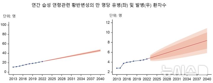 [서울=뉴시스] 연간 습성 연령관련 황반변성의 만 명당 유병(좌) 및 발병(우) 환자수. (사진= 분당서울대병원 제공)
