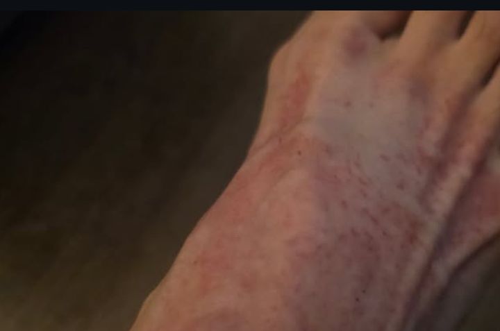 [서울=뉴시스] 아나운서 출신 방송인 윤영미가 유통기한이 지난 화장품을 발에 바랐다가 심한 피부 트러블을 겪었다고 토로했다. (사진=윤영미 인스타그램) 2025.12.09. photo@newsis.com  *재판매 및 DB 금지