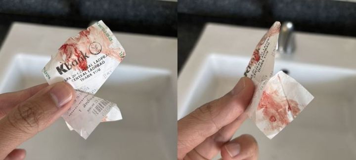 태국 방콕의 지하철(MRT) 열차 안에서 정체불명의 남성이 승객의 팔에 피를 문지른 사건이 발생해 현지에서 우려가 커지고 있다.2025.12.12.(사진=태국 더타이거 캡처) *재판매 및 DB 금지