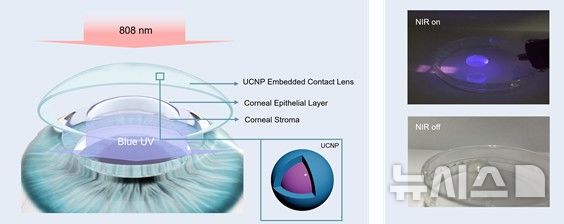 [포항=뉴시스] 송종욱 기자 = 포스텍 신소재공학과 한세광 교수 연구팀이 부산대 유기소재시스템공학과 김기수 교수, 연세대 의대 안과학교실 김태임 교수와 함께 각막 손상 없이 원추각막병증 및 근시 교정 치료법을 개발했다. 사진은 상향 변환 나노 입자가 담지된 콘택트렌즈 모식도와 근적외선 빛 조사 때 자외선 및 청색광을 발광하는 콘택트렌즈 모습. (사진=포스텍 제공) 2025.12.12. photo@newsis.com  