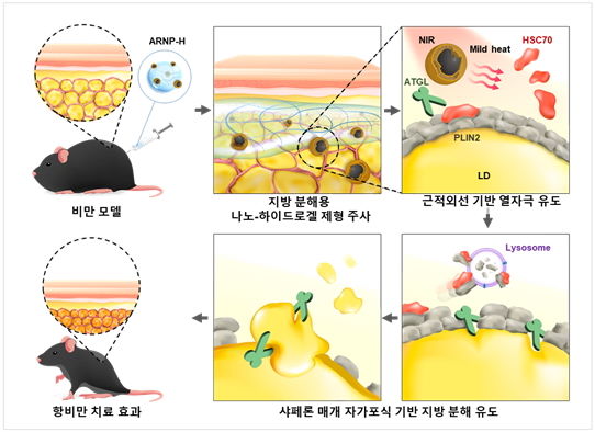 [서울=뉴시스] 근적외선 감응형 나노-하이드로겔 치료제를 통한 자가포식 기반 항비만 치료 모식도. (사진=숙명여대 제공) 2025.12.16. photo@newsis.com *재판매 및 DB 금지