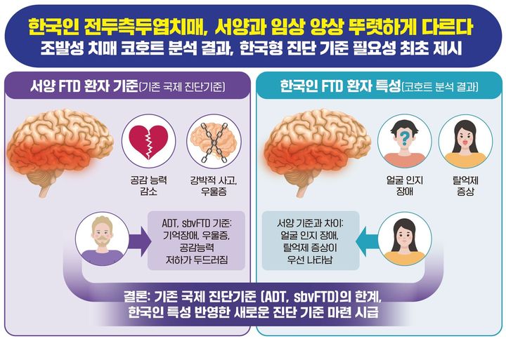 "한국인 전두측두엽치매, 서양과 달라" 첫 확인…"외국 진단기준 한계"