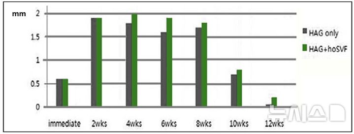 [서울=뉴시스] 기질혈관분획(SVF)-히알루론산 주사그룹에서 안와 용적 증가 효과가 더욱 길게 유지됐다. (사진= 차병원 제공) 