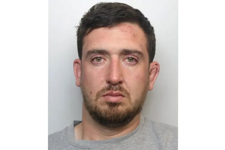 [뉴시스] 절친 결혼식에서 술에 취해 하객 손가락을 물어 뜯은 영국 30대 남성. (사진=CPS/SWNS) 2025.12.21 *재판매 및 DB 금지