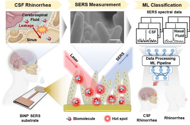 [서울=뉴시스] AI 기반 뇌척수액 누출 진단 플랫폼의 개발 모식도. (사진=성균관대 제공) 2025.12.22. photo@newsis.com *재판매 및 DB 금지
