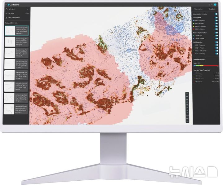 [서울=뉴시스] 루닛 스코프. (사진= 루닛 제공)