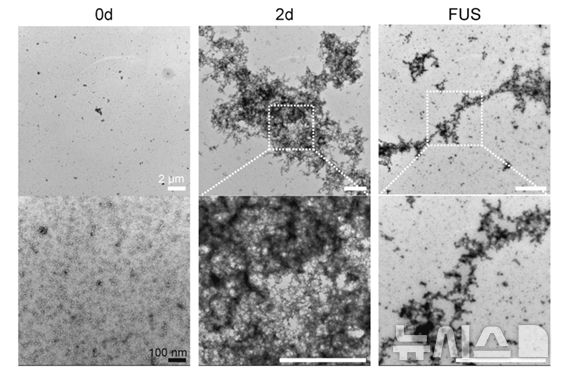 [서울=뉴시스] 집속 초음파에 의한 아밀로이드 베타 응집체 및 신경세포 보호 효과. 전자현미경 촬영 결과, 뭉쳐있던 아밀로이드 응집체(2d)가 초음파 조사 후(FUS) 잘게 부서진 것을 확인할 수 있다. (사진= 한림대동탄성심병원 제공)