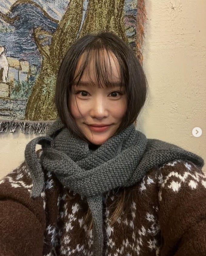 [뉴시스]키즈 크리에이터 헤이지니가 모발 이식을 받고 3일 뒤 찍은 사진. (사진 = 헤이지니 인스타그램 캡처) *재판매 및 DB 금지