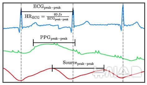 [서울=뉴시스] 심전도(파란색), 광용적맥파 원 신호(초록색), 인공지능으로 분리된 근원 신호(빨간색) 비교. 분리된 근원 신호에서는 심전도 기준 심장 박동 시점과 일치하는 피크가 뚜렷하게 나타난다. (사진= 서울대병원 제공)