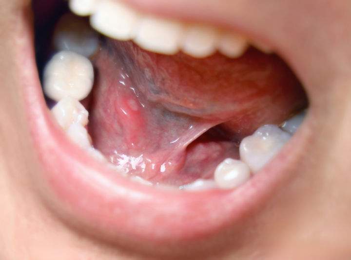 AI가 혀를 분석한다…당뇨·위암 조기 진단 가능성