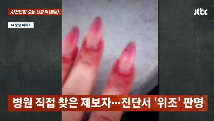 [뉴시스] 한 외국인 여성이 네일 시술을 받은 후 인공지능(AI)으로 조작한 사진을 이용해 환불과 진료비를 청구한 사연이 소개됐다. (사진=JTBC 사건반장 캡처) *재판매 및 DB 금지