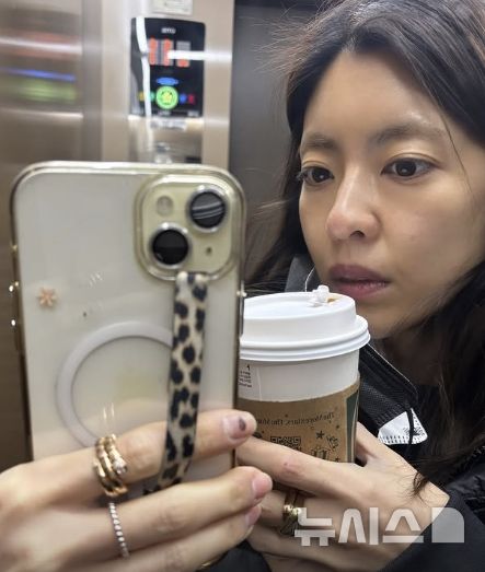 이윤지, 겨울철 낙상사고 "계단에서 넘어져"