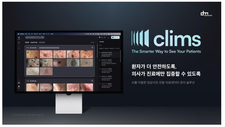 3시간 걸리던 사진분류가 몇 초만에...AI가 바꾼 피부과[빠정예진] - 뉴스 썸네일 이미지