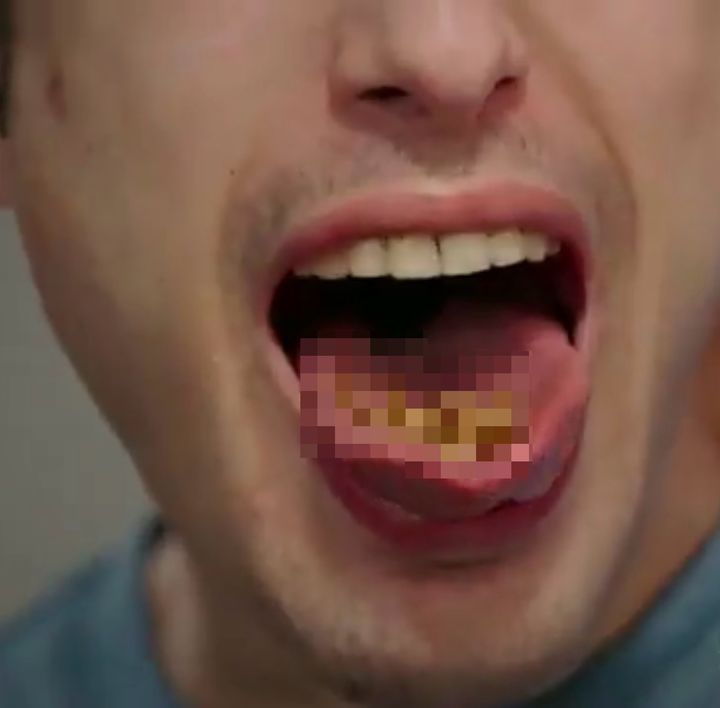 [뉴시스] 미국의 한 남성이 하루에 살아 있는 벌레 100마리를 먹는 독특한 식습관을 공개해 충격을 주고 있다. (사진=엑스 캡처) *재판매 및 DB 금지