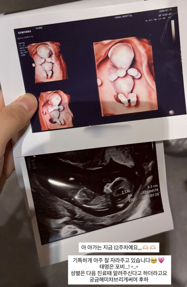 [서울=뉴시스] 인플루언서 김지영이 19일 태명을 공개했다. (사진=김지영 인스타그램 캡처) 2026.01.19. photo@newsis.com *재판매 및 DB 금지