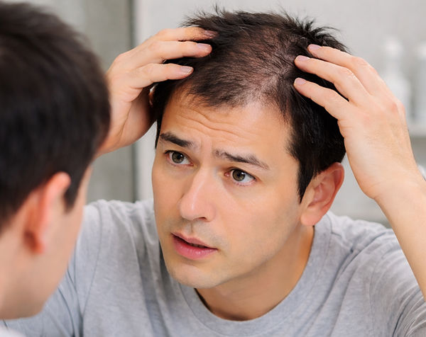 [서울=뉴시스] 기존의 남성호르몬 억제 치료제와 차별화되는 새로운 작용기전의 탈모 신약 개발에 국내 제약바이오 기업들이 나섰다.&nbsp; (사진=AI 제작) 2021.09.24 *재판매 및 DB 금지