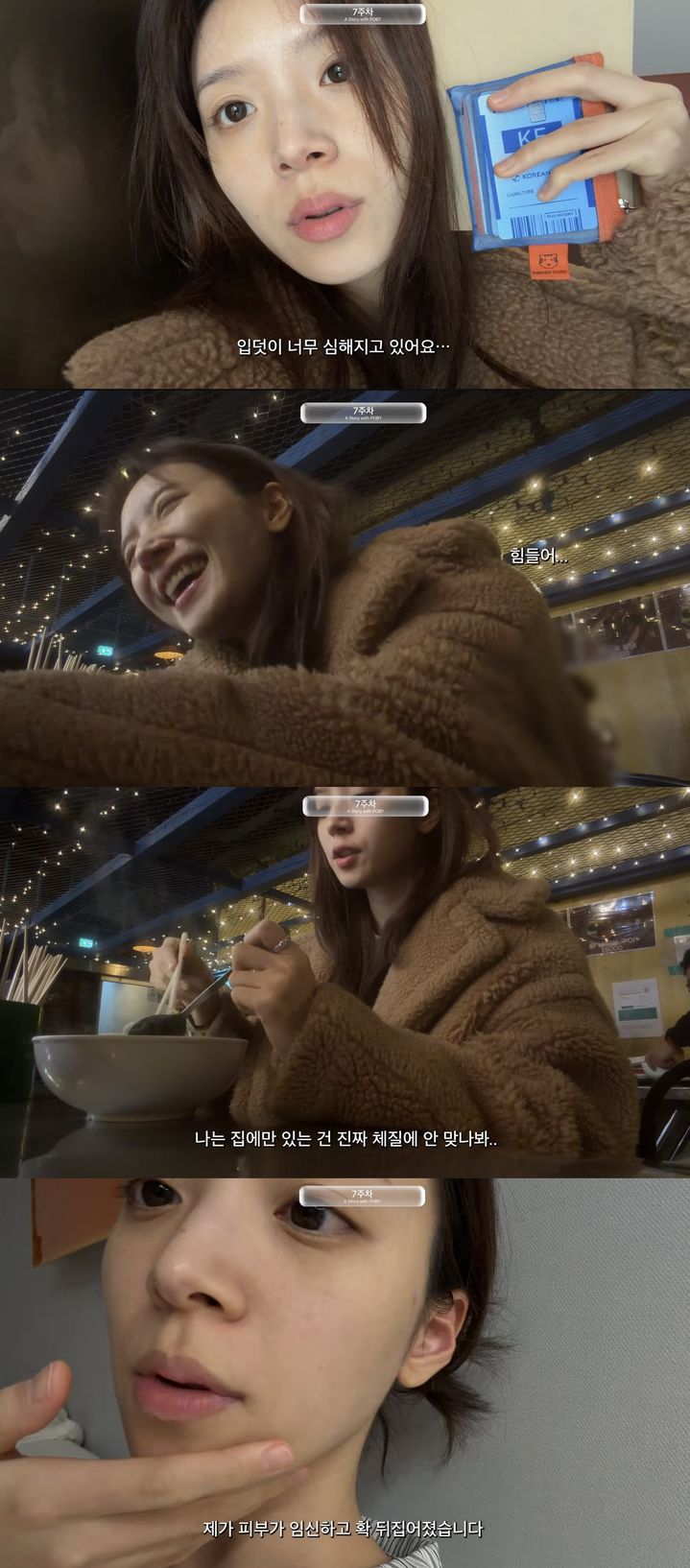 혼전임신 김지영, 결국 눈물 "피부 다 뒤집어져…너무 힘들다"