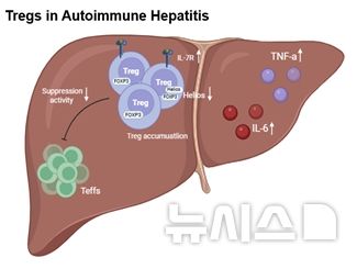 [서울=뉴시스] 자가면역간염 환자의 조절 T 세포(Treg) 기능 손상을 나타낸 그림. (사진= 서울성모병원 제공)