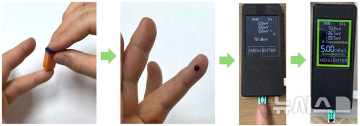 말기신장병 환자, 피 한방울로 칼륨 측정…오차 5% 미만