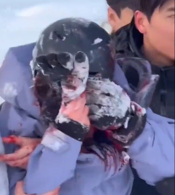 [뉴시스] 중국의 한 스키 관광객이 희귀 야생동물인 눈표범과 사진을 찍으려다 공격을 받아 중상을 입는 사고가 발생했다. (사진='X' 캡처) *재판매 및 DB금지 *재판매 및 DB 금지