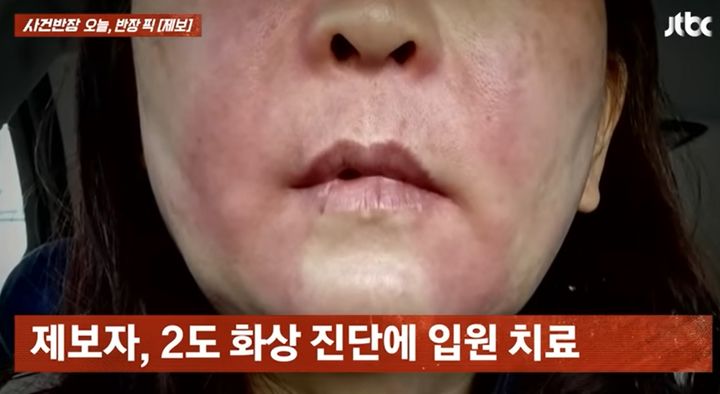 마트 직원 따라 실로 묶어 구웠다가…곱창 폭발로 화상