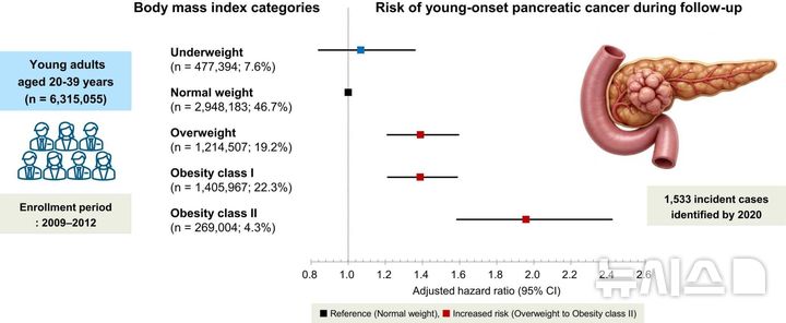 [서울=뉴시스] 2030 젊은 췌장암 환자의 주요 발병 원인으로 비만이 꼽힌 가운데, 과체중 단계에서부터 발생 위험이 급격히 증가하는 것으로 나타났다. (사진= 삼성서울병원 제공)