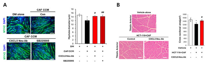 그림(A)는 대장암 환자 유래 CAF 배양액(CAF CCM)을 처리하여 위축된 근관세포에 CXCL5 중화항체 및 수용체 억제제를 처리한 후 근관 지름의 변화를 측정한 것으로, 약물 처리에 의해 정상 수준으로 회복되는 효능이 확인되었다. 그림(B)는 암세포와 CAF가 이식된 마우스 모델에 CXCL5 중화항체를 투여한 후 근육 조직의 단면적 변화를 측정한 것으로, 중화항체 투여군에서 대조군 대비 유의미한 근육 회복 효과를 확인하였다. (그래픽=GIST 제공) photo@newsis.com *재판매 및 DB 금지