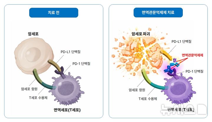 "위암에 쓰는 '이 항암제', 남성에만 효과"…이유 있었다