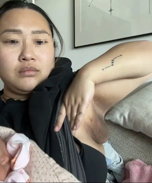 출산 후 '세 번째 가슴'이 생겼다?…젖꼭지도 있어